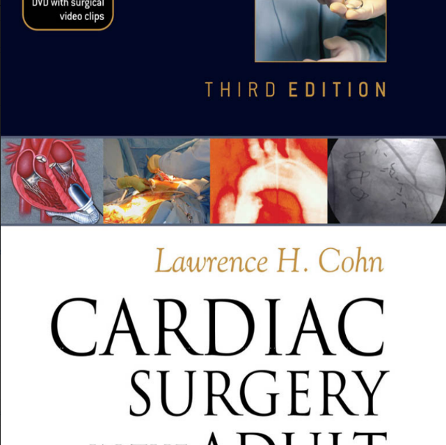 Cardiac Surgery | Ebook Poltekkes Tasikmalaya